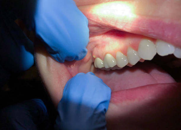 Best Broken or Cracked Tooth Emergency Dentist in Rohnert Park, CA